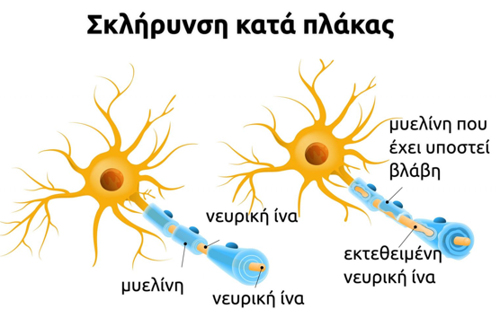 sklirinsi sklirinsi